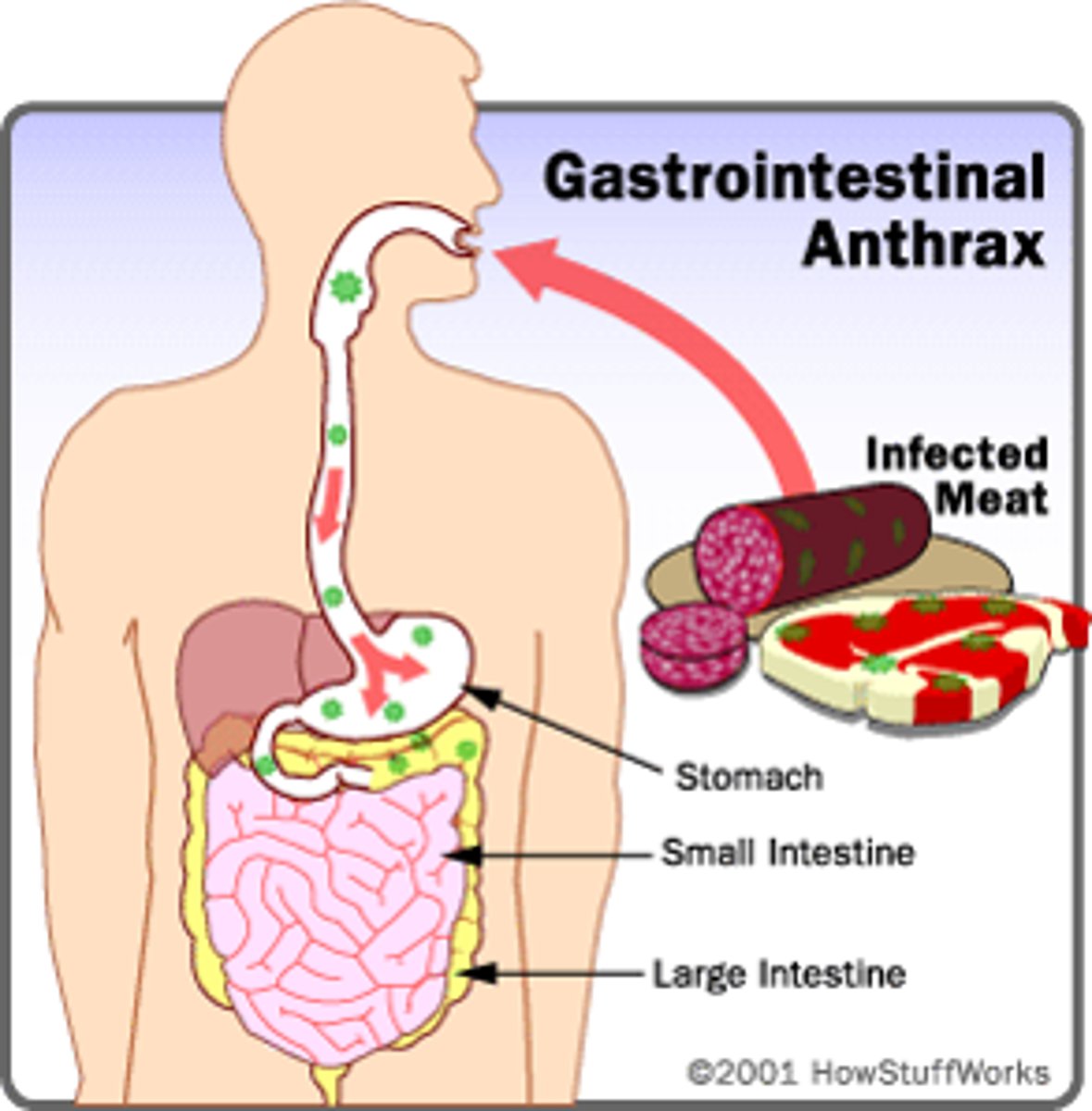<p>consumption of infected meat.</p><p>fatal, uncommon</p>