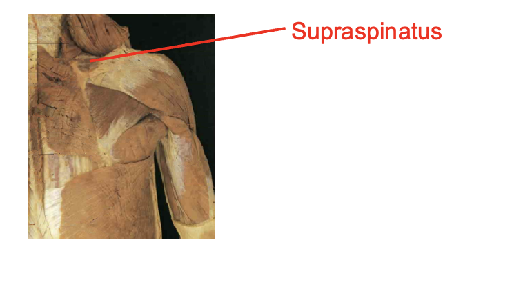 <ul><li><p>supraspinatus</p></li></ul><p></p><p>Origin</p><ul><li><p>supraspinous fossa</p></li></ul><p>Inserition</p><ul><li><p>superiro greater tubercle</p></li></ul><p></p><img src="https://knowt-user-attachments.s3.amazonaws.com/3f364f63-e579-4596-a857-5e6903e3847b.png" data-width="100%" data-align="center"><p></p>