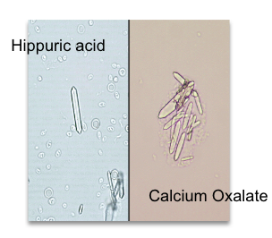 <ul><li><p>polarization (calcium oxalate!) </p></li><li><p>solubility</p><ul><li><p>Calcium oxalate: HCl</p></li><li><p>Hippuric acid: alkaline</p></li></ul></li></ul><p></p>