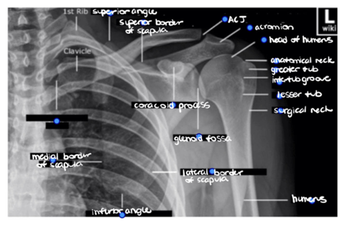 <p>ID the missing structure.</p>