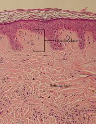 <p>ridges of the skin</p>