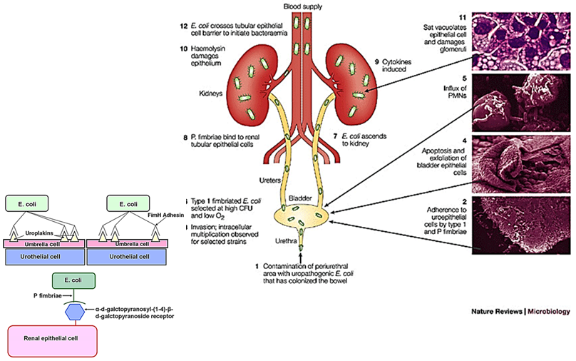 <p>Bacteria <strong>colonize the colon</strong>, spread to the <strong>perineal region</strong>, and ascend into the <strong>urinary tract</strong>.</p>