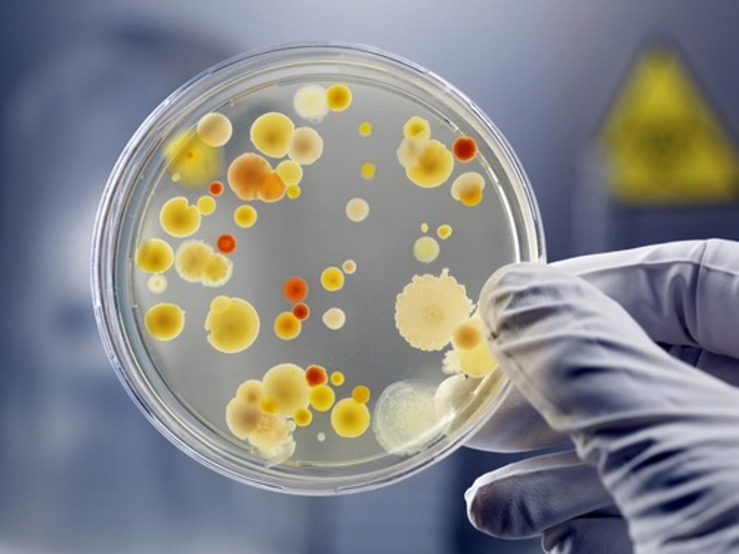 <p>The abnormal manifestation of parasitic microorganisms within an area of the body.</p>