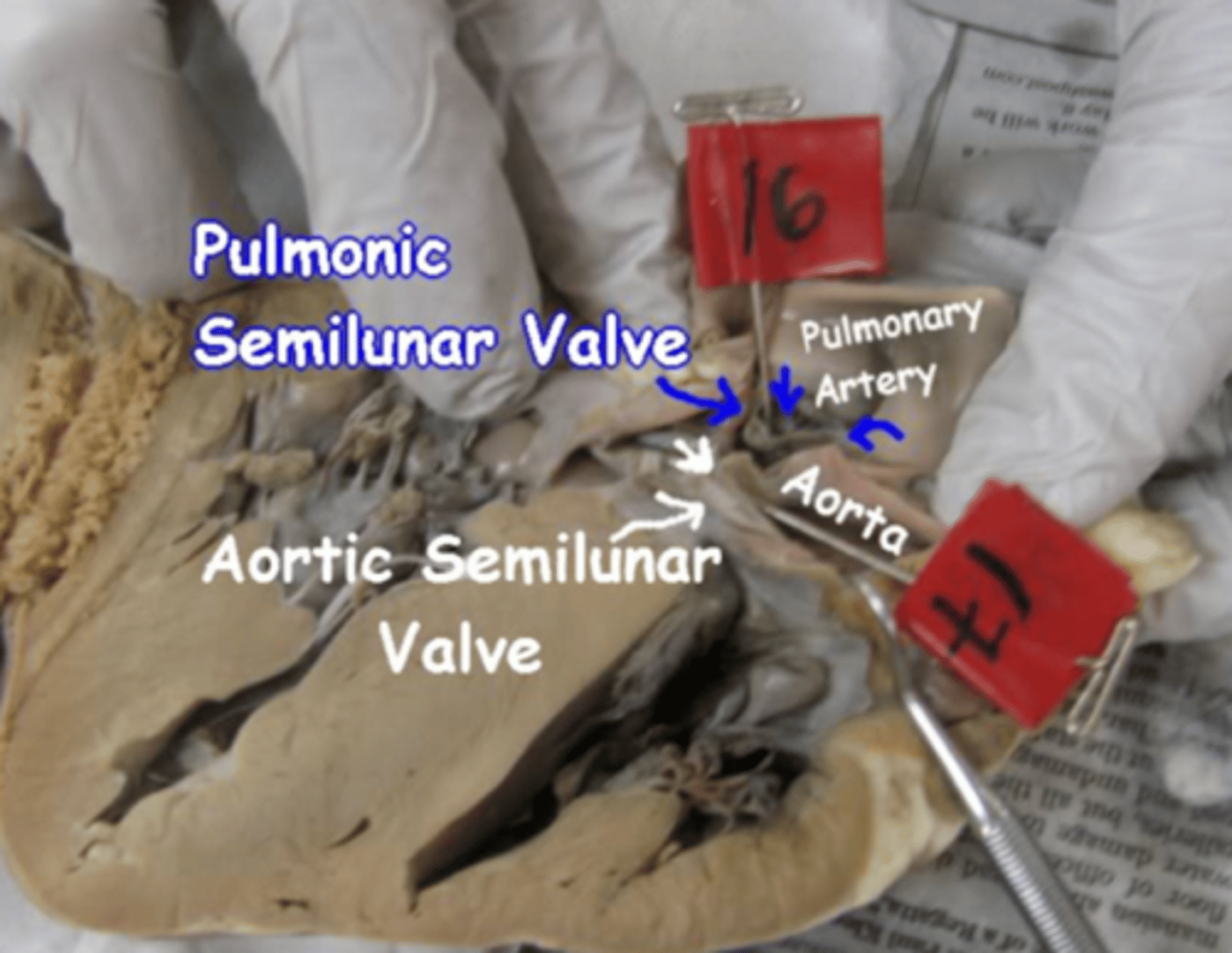 <p>prevents blood from flowing back into the right ventricle</p>