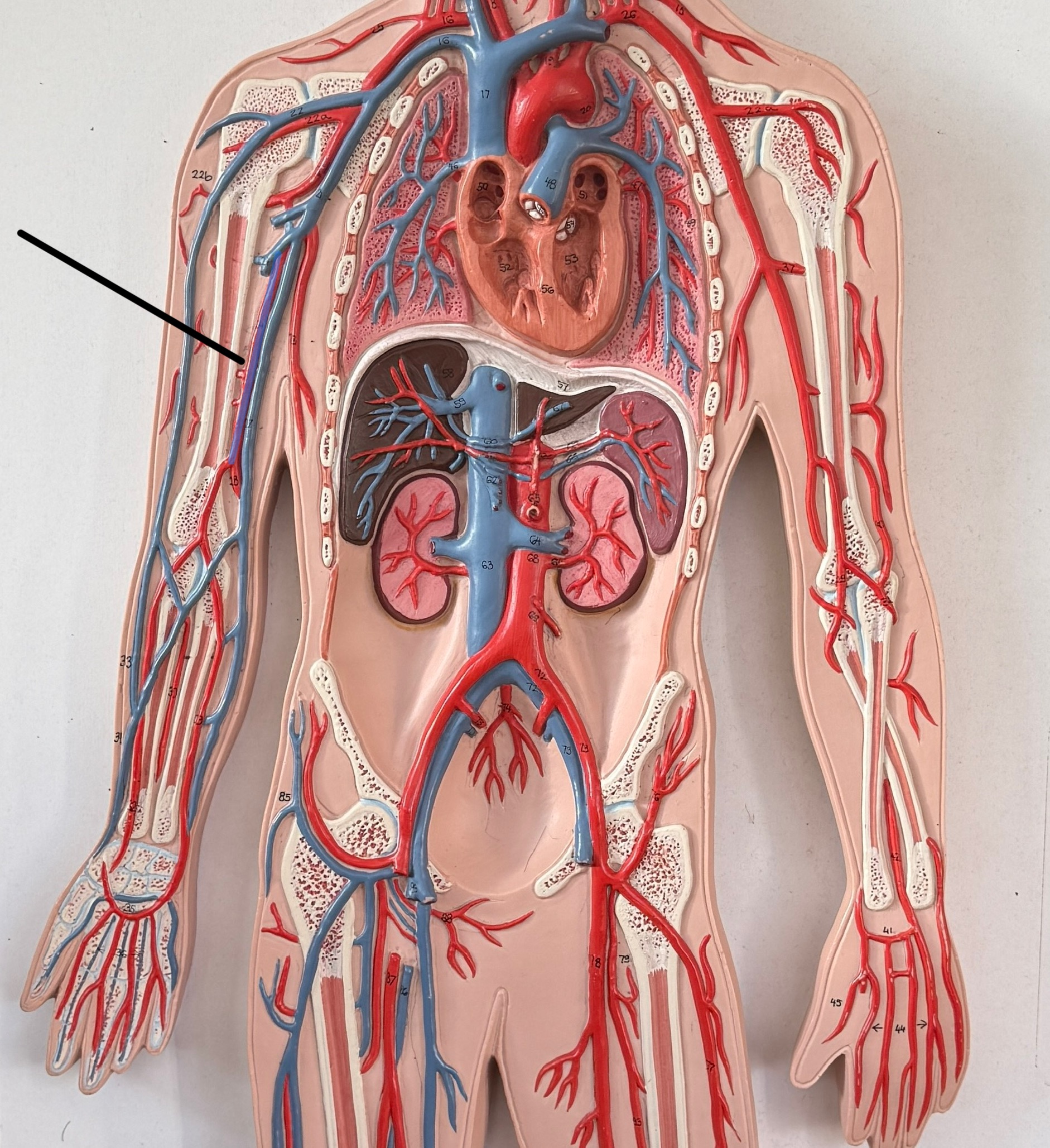 <p>What is this artery?</p>
