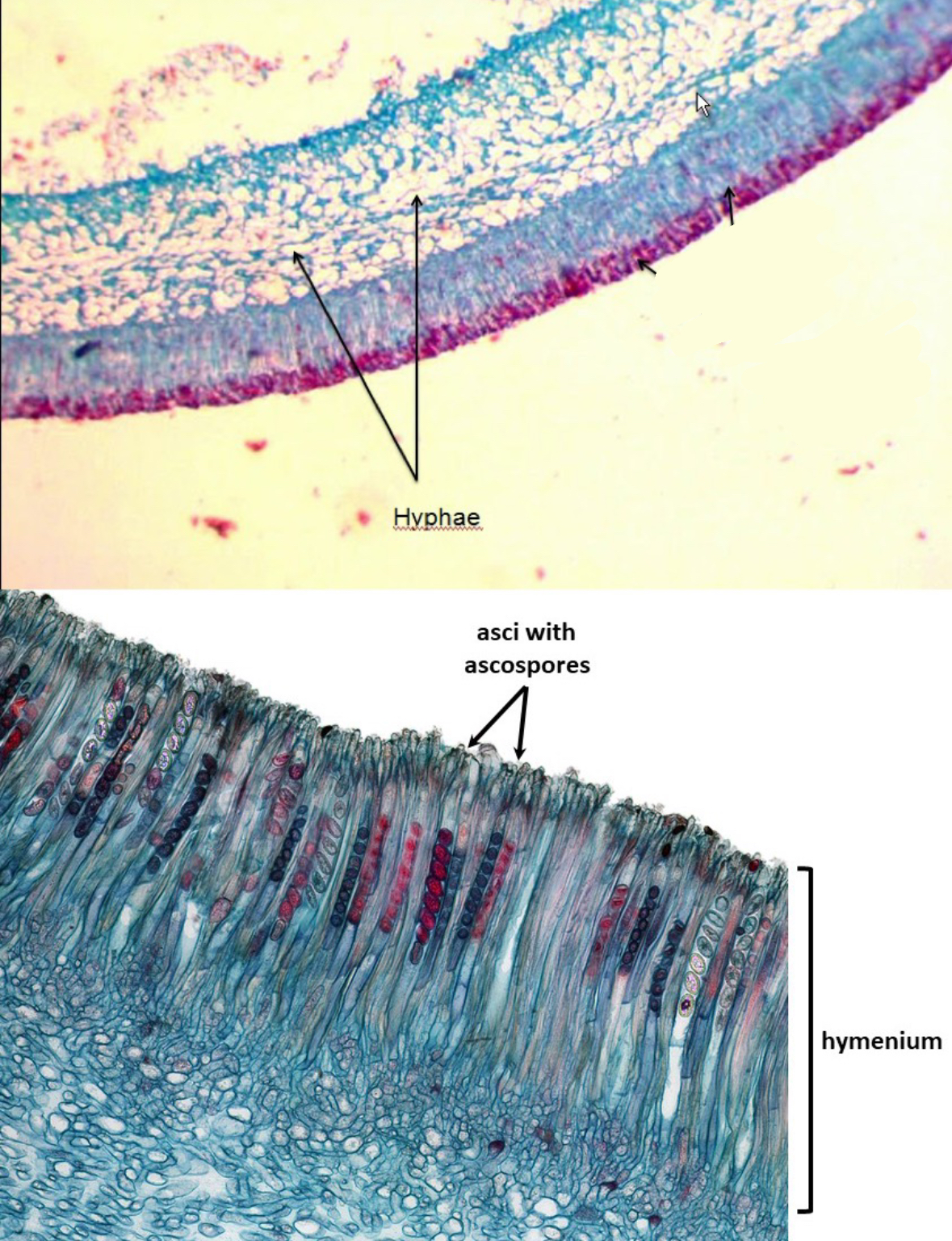<p>Domain: Eukarya</p><p>Kingdom: Fungi</p><p>Clade: Ascomycota</p>
