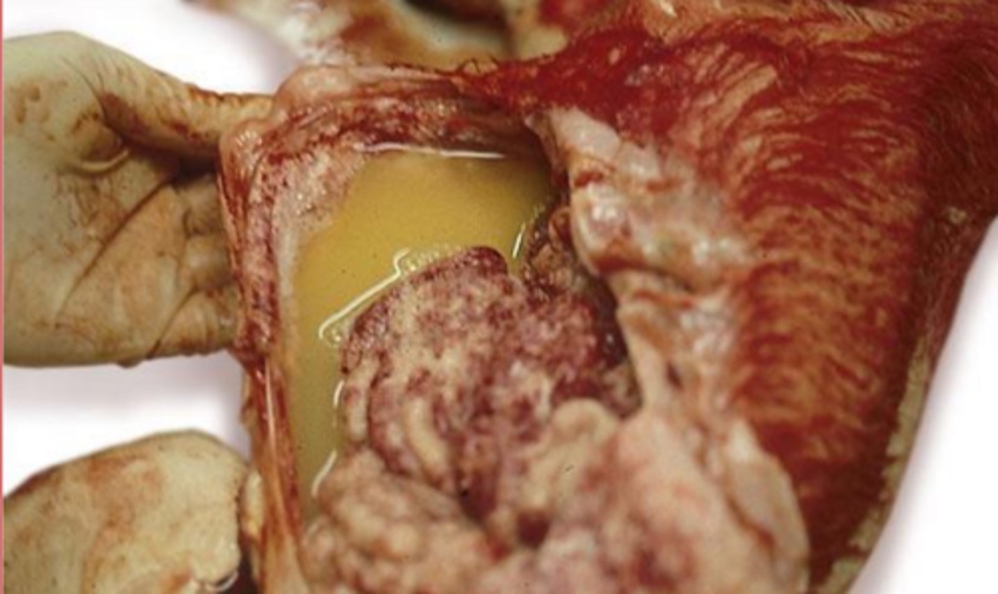 <p>what kind of effusion in this perotineal effusion?</p>