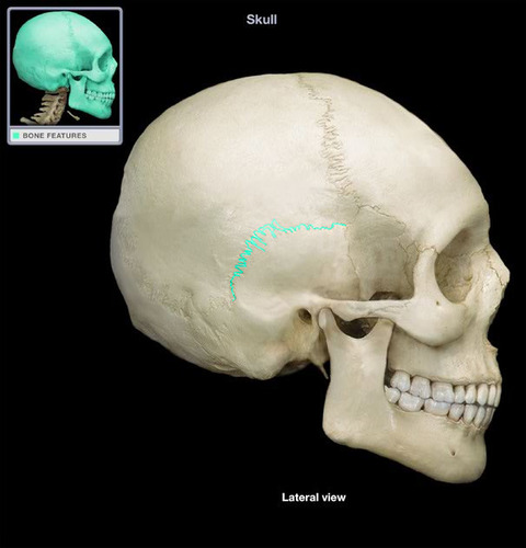 Between parietal and temporal bones
