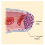 <p>normally prostacyclin (platelet repellent) coats endothelium</p><p>but…</p><p>broken vessel exposes collagen</p><p>platelets grow pseudopods (tendrils of platelet)—stick to damaged vessel; pseudopods contract and draw walls of vessel together forming platelet plug</p><p>platelets degranulate, release:</p><p>serotonin- vasoconstricts</p><p>Thromboxane A2- promotes platelet aggregation, degranulation, and vasoconstriction</p><p>Positive feedback cycle active until break in small vessel seals</p>