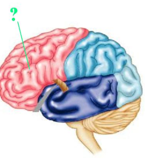 <p><span><span>Identify the indicated lobe of the brain.</span></span></p>