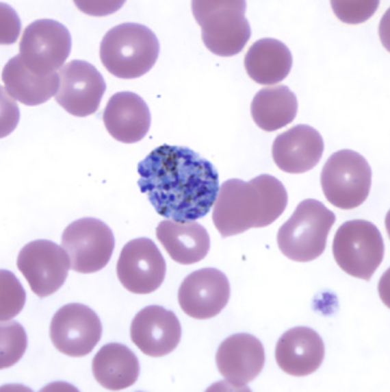 <p>What is this? What disease does it cause? What super group is it in?</p>