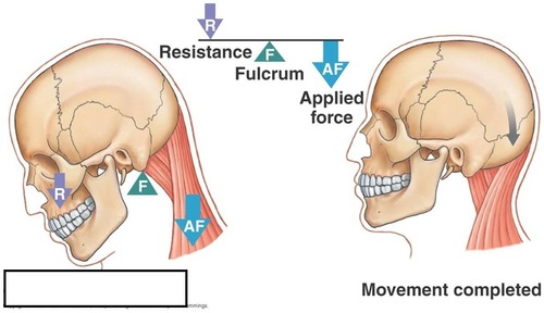 the head
- the occipital condyle is the fulcrum 
- the nuchal muscles are the force
- the head is the weight