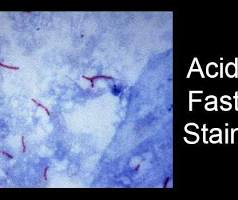 <p>How does acid fast staining work?</p>