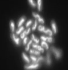 <p>Confocal</p>