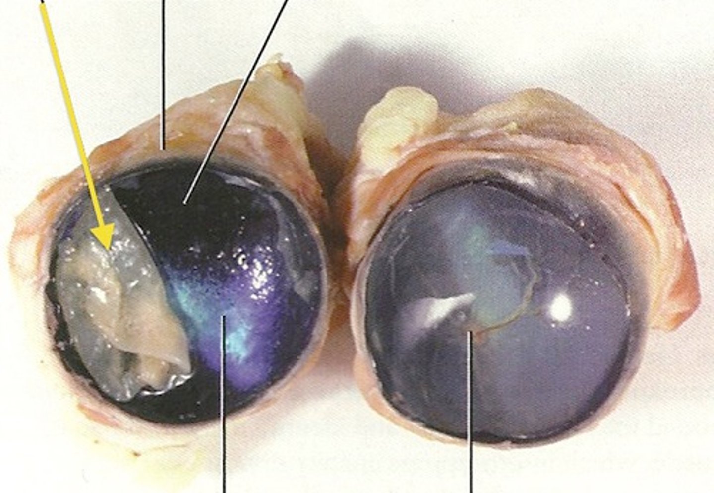 <p>thin, translucent film covering the eye, beneath the choroid.</p>