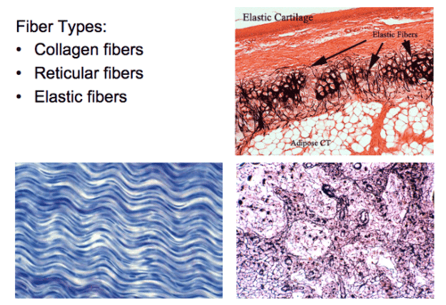 <p>Collagen</p><p>Elastic</p><p>Reticular</p>