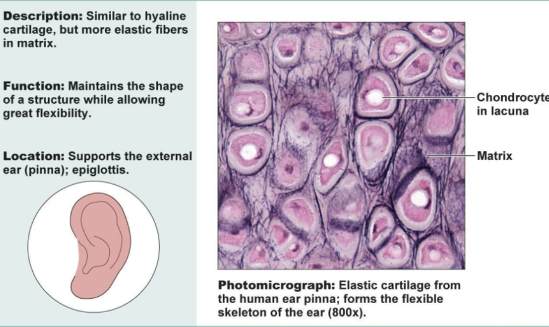 <p>Similar to hyaline cartilage but more elastic fibers in matrix. Functions to maintain the shape of a structure while allowing great flexibility. Supports ear</p>