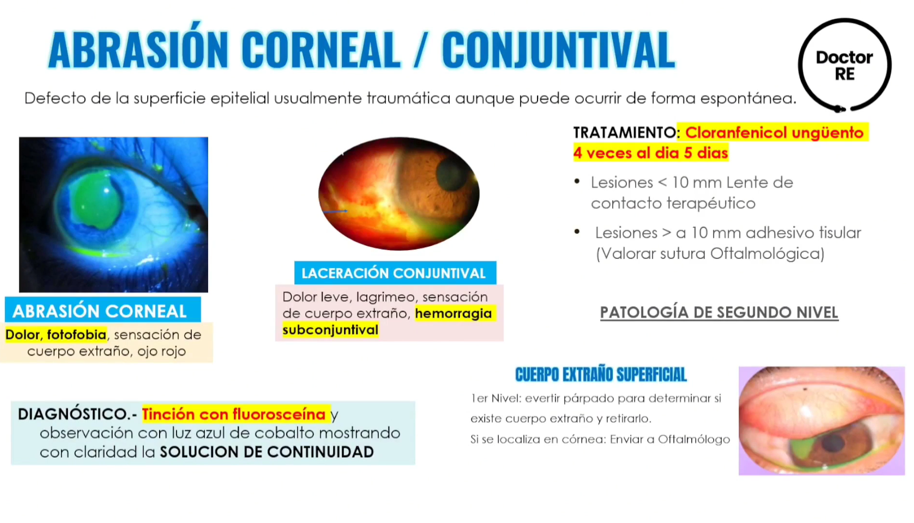 <ol><li><p>HEMORRAGIA SUBCONJUNTIVAL </p></li><li><p>DOLOR LEVE </p></li><li><p>LAGRIMEO</p></li><li><p>SENSACION DE CUERPO EXTRAÑO </p></li></ol><p></p>