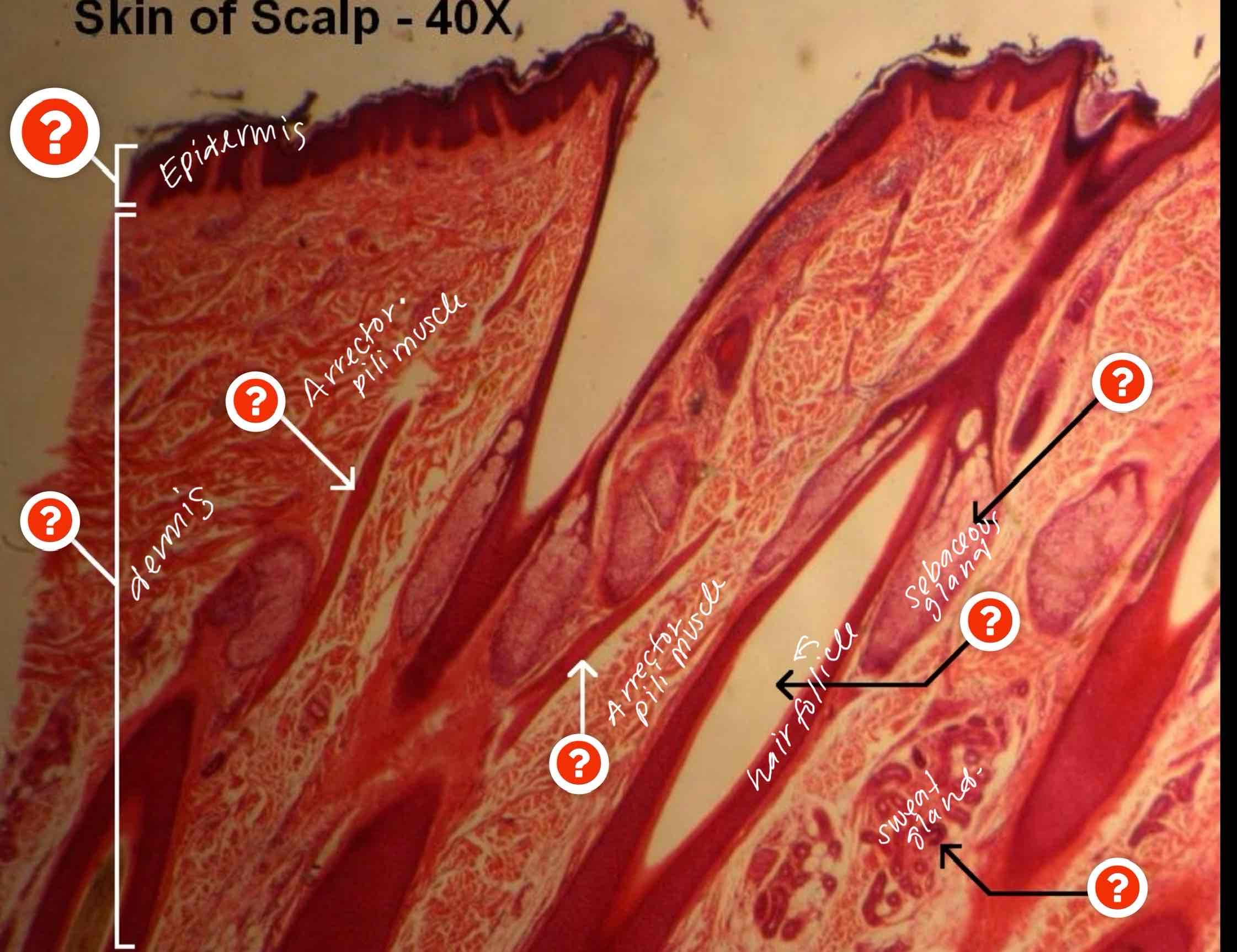 <p>Can you identify the parts of the scalp </p>