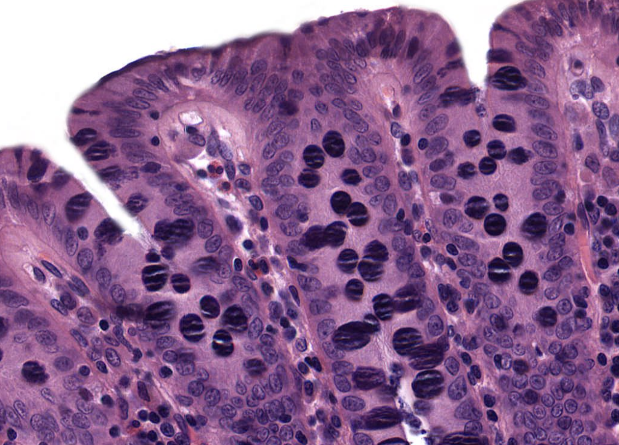 <p>Columnar Epithelium in Colon</p>