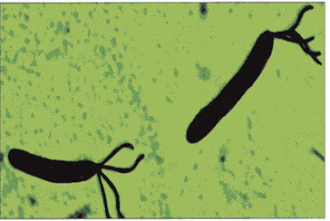 <p>2 or more flagellum at one end</p>