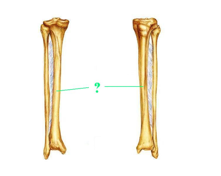 <p>Is the indicated bone from the right or left side of the body?</p>