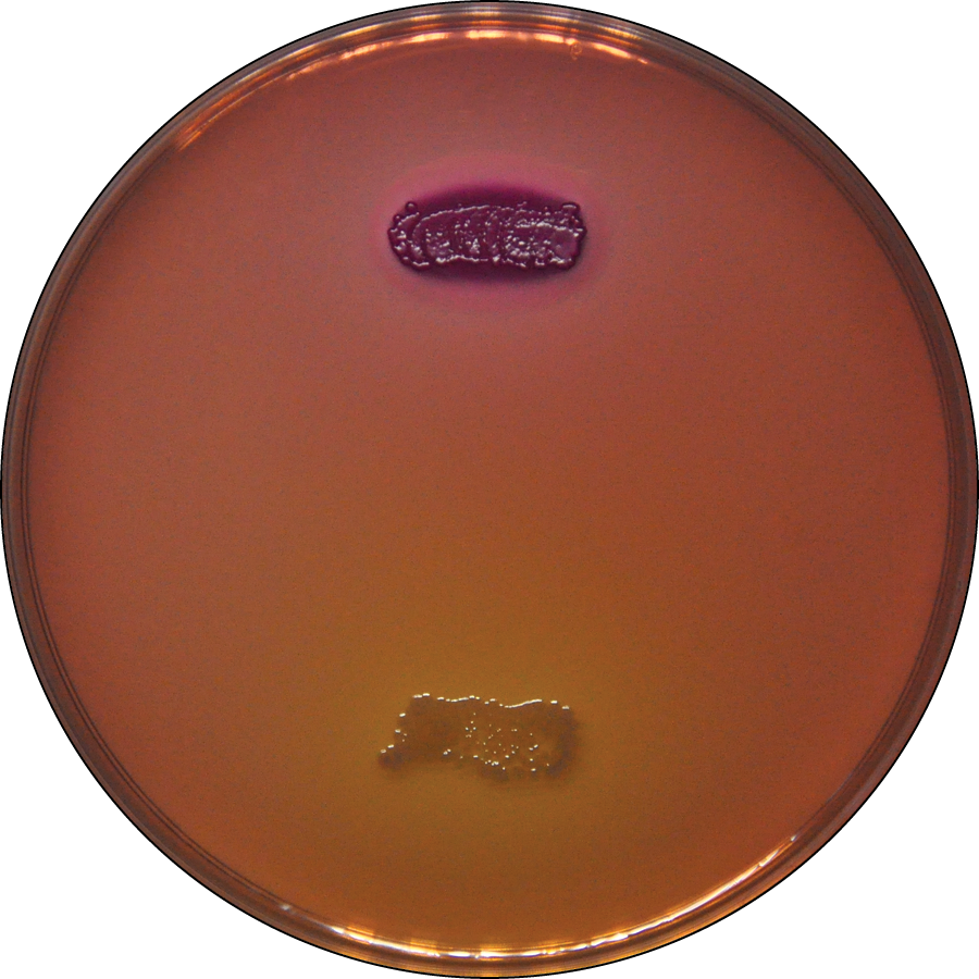 What is the name of this medium? What are the results for the organisms on the top and bottom (positive or negative)? What does this indicate about these organisms?