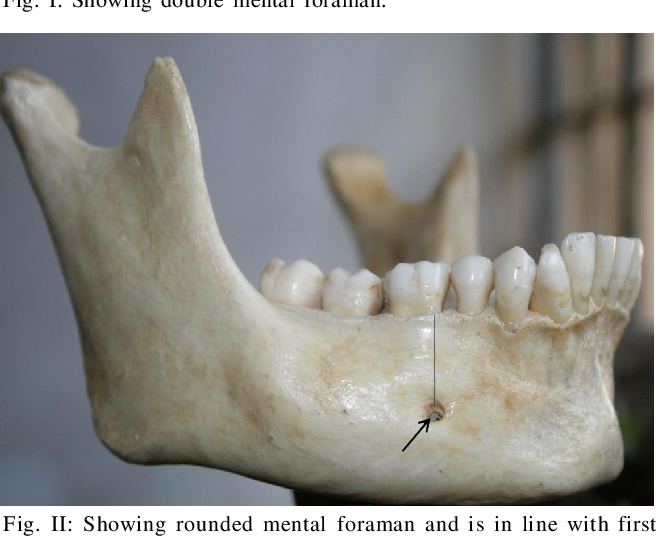of the mandible 