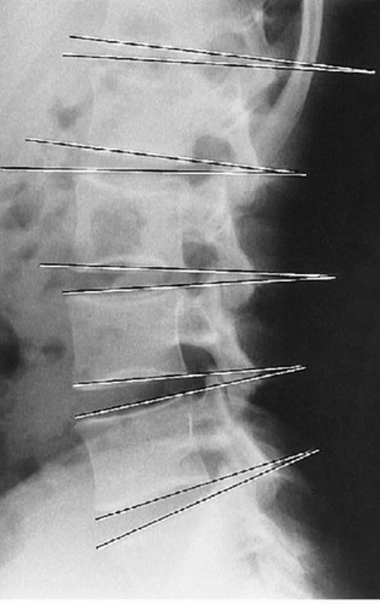 <p>What line of mensuration is this?</p>