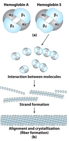 <p>Glu6—&gt; Val in the beta chain of haemoglobin</p><p>The new valine side chain can bind to a different haemoglobin molecules to form a strand</p><p>This will sickle the red blood cell</p><p>The sickled blood cells clog small capillaries and impair blood flow because of the long haemoglobin fibres</p><p>This will result in painful swellings and a high risk of a stroke</p>