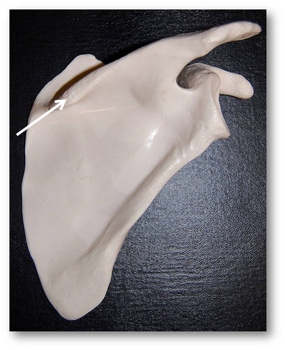 Name this specific part of the scapula.