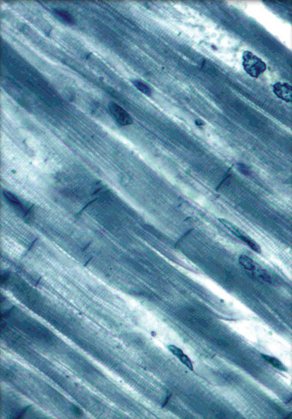 <p>what type of muscle is this?</p>