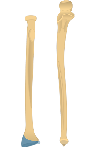 <p>What bone structure is this?</p>