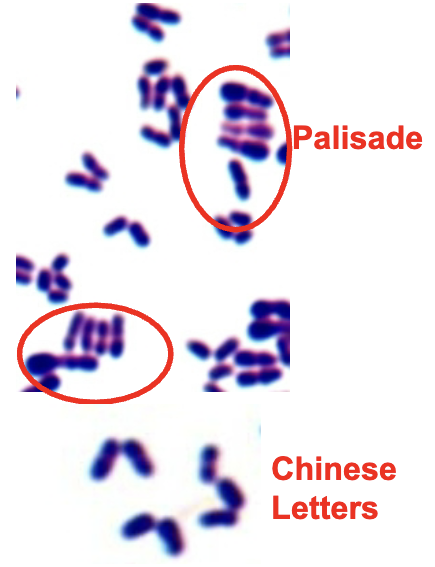 <p>found in soil &amp; water, on skin &amp; mucus membranes in humans &amp; animals. pleomorphic gram positive rods. appearance: palisade (picket fence) or Chinese letter configuration. metachromatic granules visble with methylene blue. normal flora (diphtheroids) can cause opportunistic infections. diphtheriae is pathogenic</p>