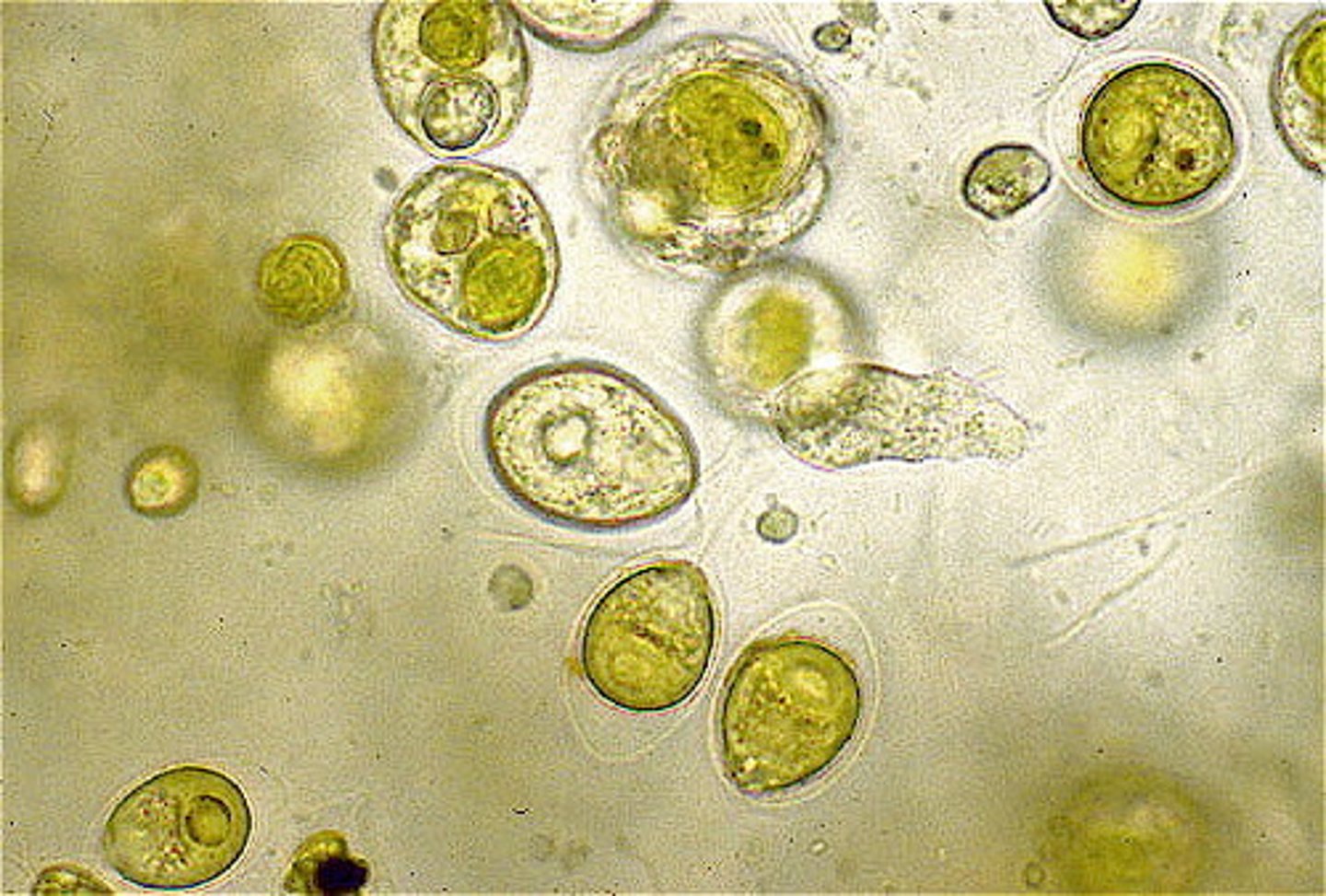 <p>A form of nutriton in which both autotrophy and heterotrophy may be utilized, depending on the avalibility of resources</p>