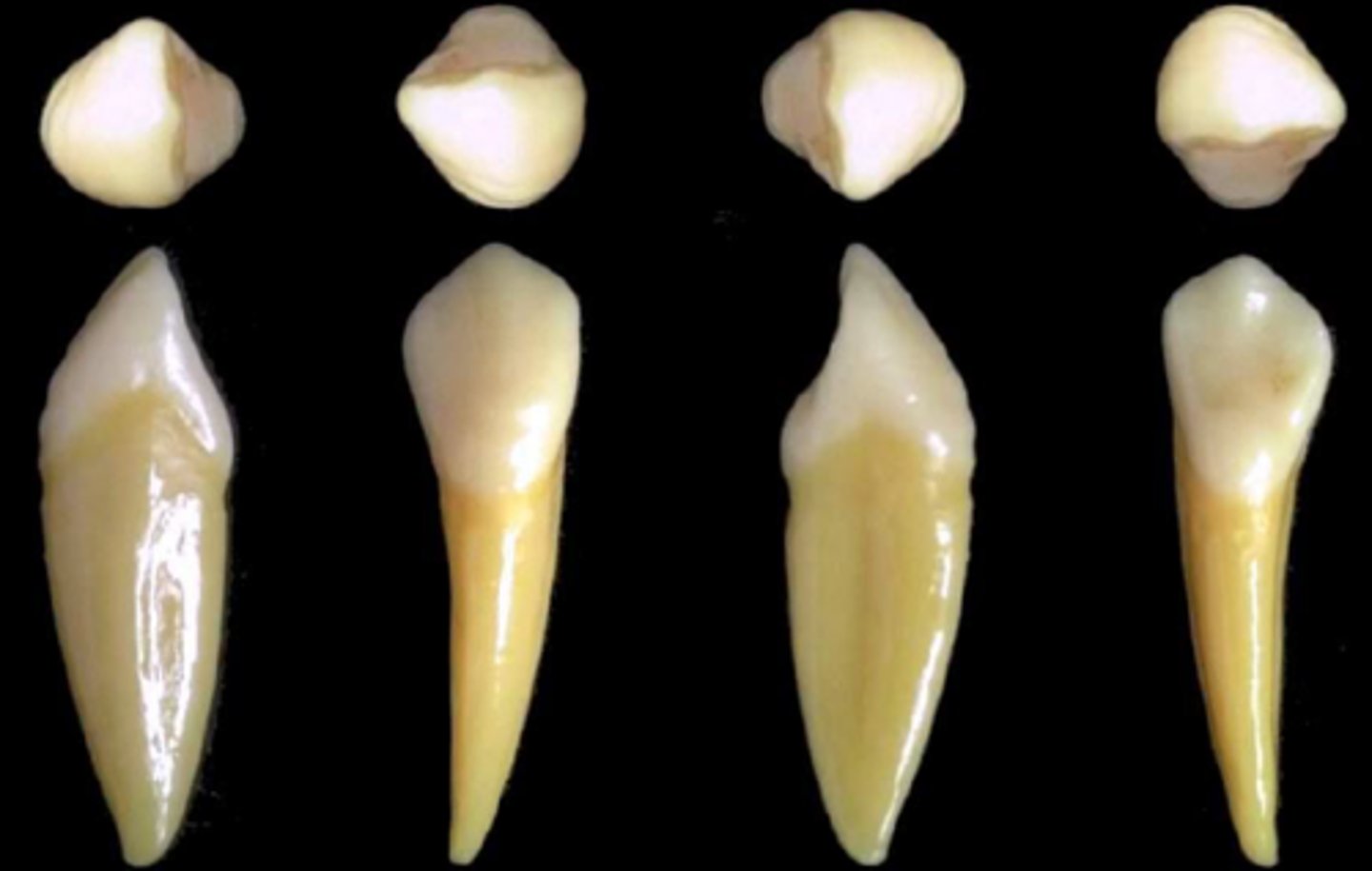 <p>what tooth is this &amp; why?</p>