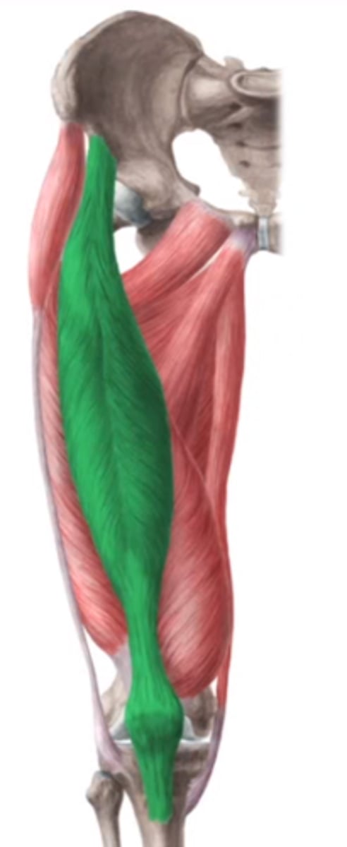 <p>is de enige die het heupgewricht overspant</p><p>O: SIAI</p><p>I: Tuberositas tibiae</p><p>W:</p><p>bij gefixeerd bekken (open keten): anteflexie, extensie van de knie + anteflexie van de heup (naar voor zwaaien van been bij gaan en lopen)</p><p>bij gefixeerd femur (gesloten keten): anteversie bekken</p><p>Inn: N. femoralis (L2-L3-L4)</p>