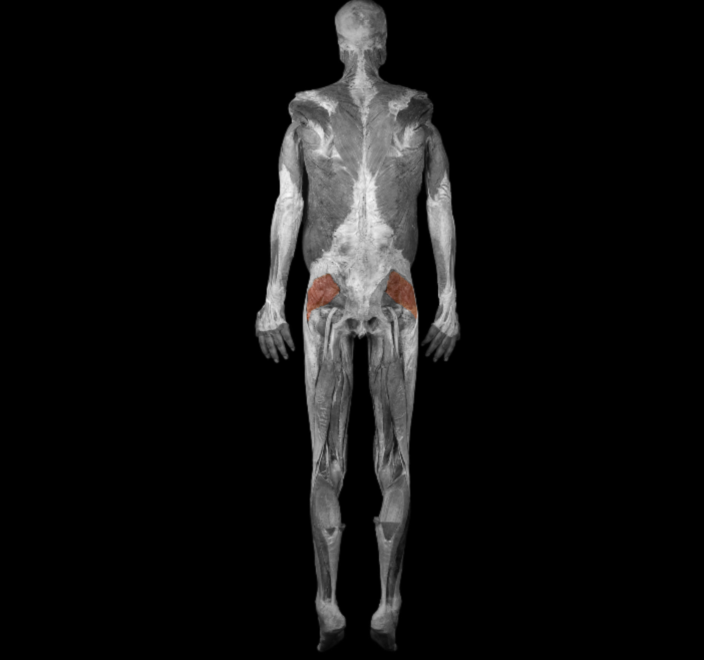 <p>deep to Maximus, upper half </p><p></p><p></p><p>origin: ilium</p><p></p><p>insertion: greater trochanter of femur</p><p></p><p>action: abduct thigh at hip, medially rotate thigh</p><p></p><p>innervation superior gluteal nerve</p>