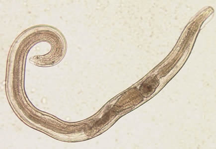 <p>Identify this parasite</p>
