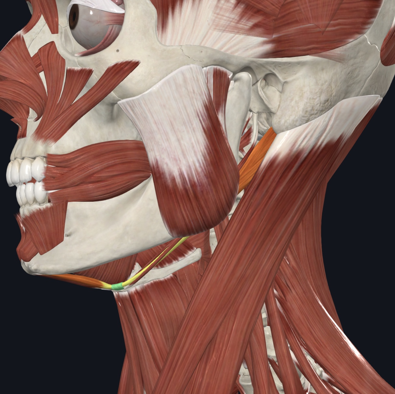 term image