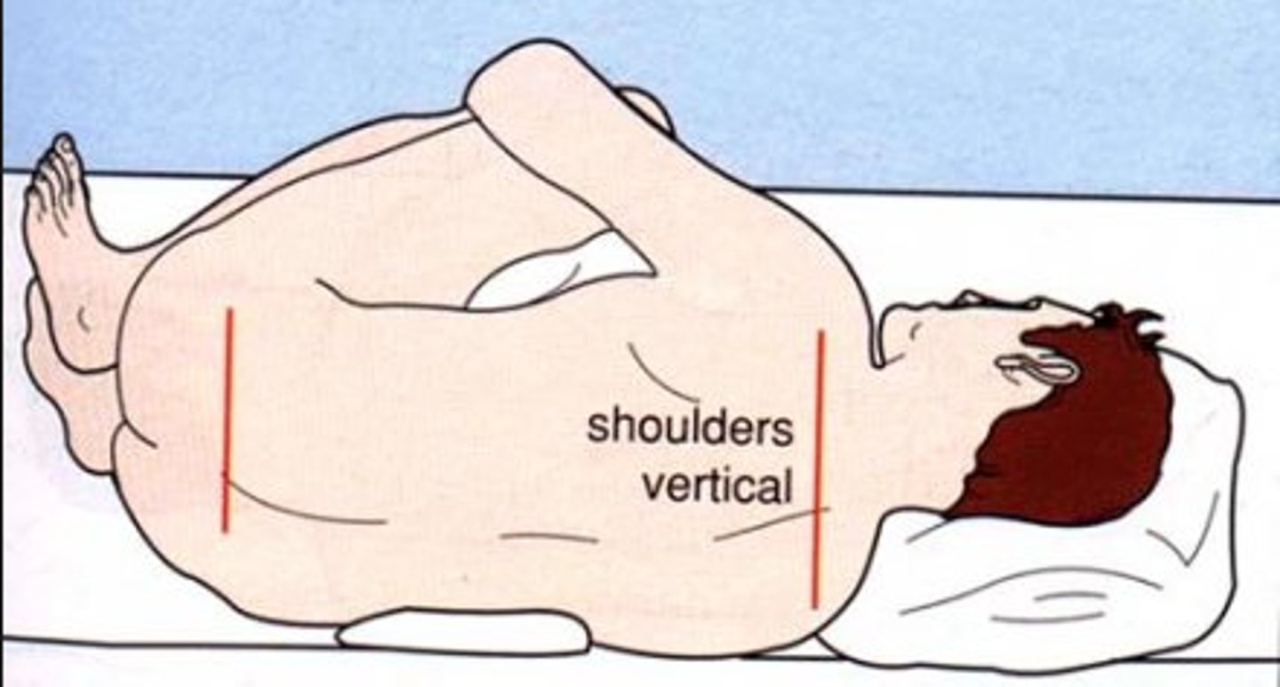 <p>- halo sign - indicates clear fluid is CSF</p><p>- Contraindications: suspected increased ICP, trauma, infection at site</p><p>- Pre: have patient void, assess for pain, explain procedure</p><p>- During: lateral recumbent position</p><p>- Post: monitor neuro status and VS, HA, nuchal rigidity</p>