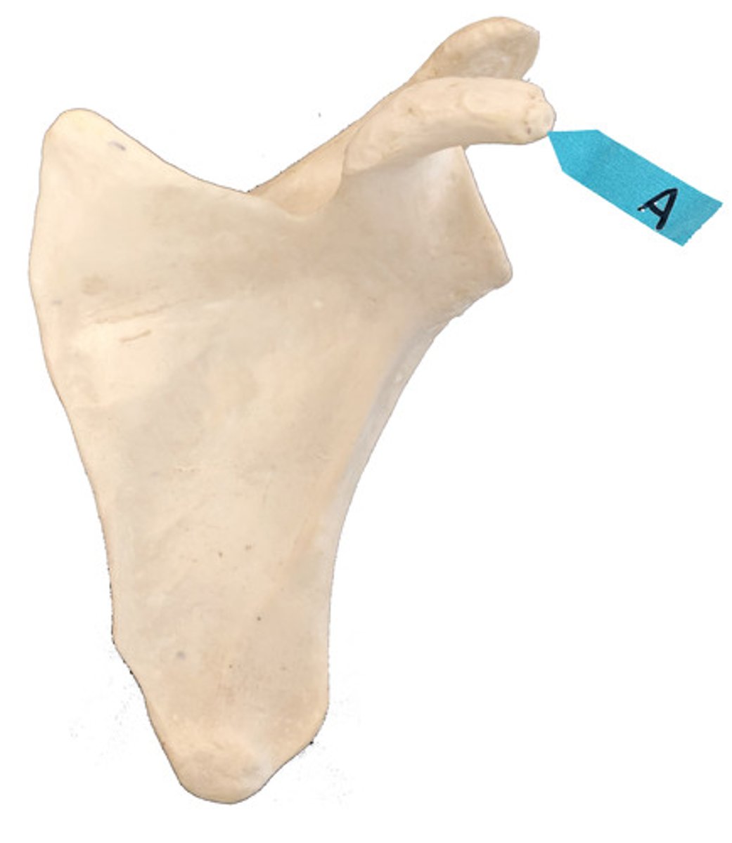 <p>Identify this bone marking.</p>