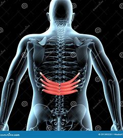 <p>depress ribs</p>