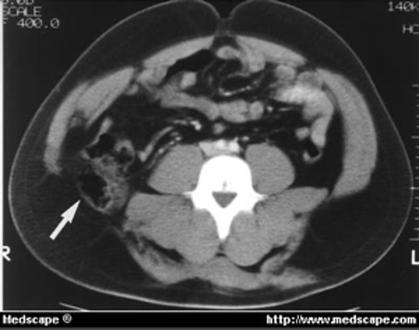 <p><em>identify the pathology</em> </p>