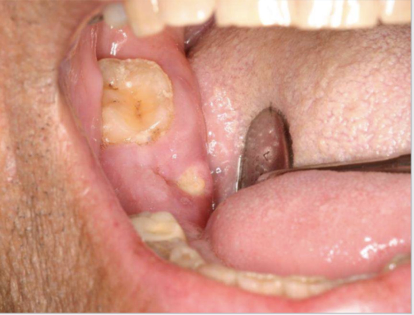 <p>what do you suspect?</p>