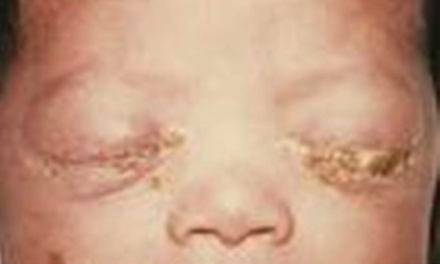 <p>oral Erythromycin</p>