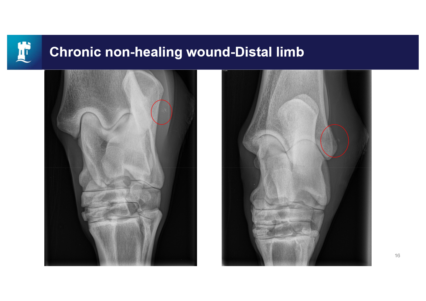 <ul><li><p><span><span>Periosteal elevation</span></span></p></li><li><p><span><span>Soft tissue swelling</span></span></p></li><li><p>bone fragment - acting as a foreign body</p><ul><li><p>debride thoroughly</p></li><li><p>flush</p></li></ul></li></ul><p></p>