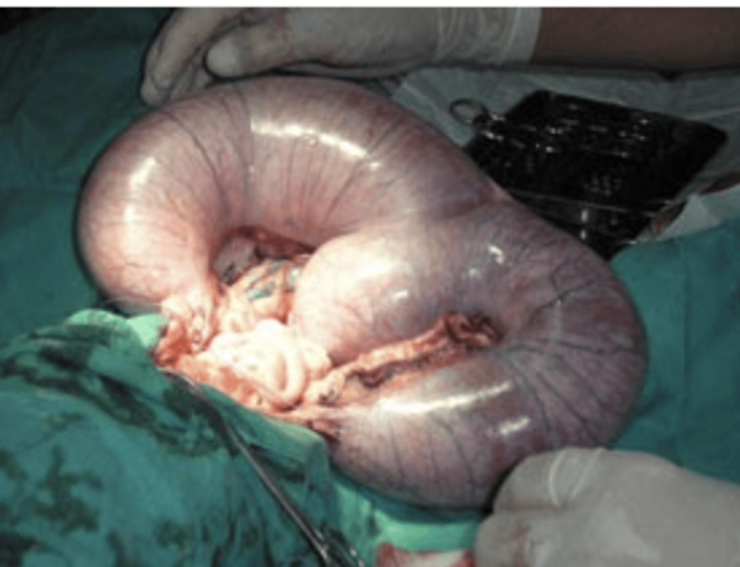 <p>what is this condition?</p>