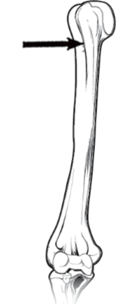 <p>A groove on the surface of a bone acting as a channel for structures like nerves or tendons</p>