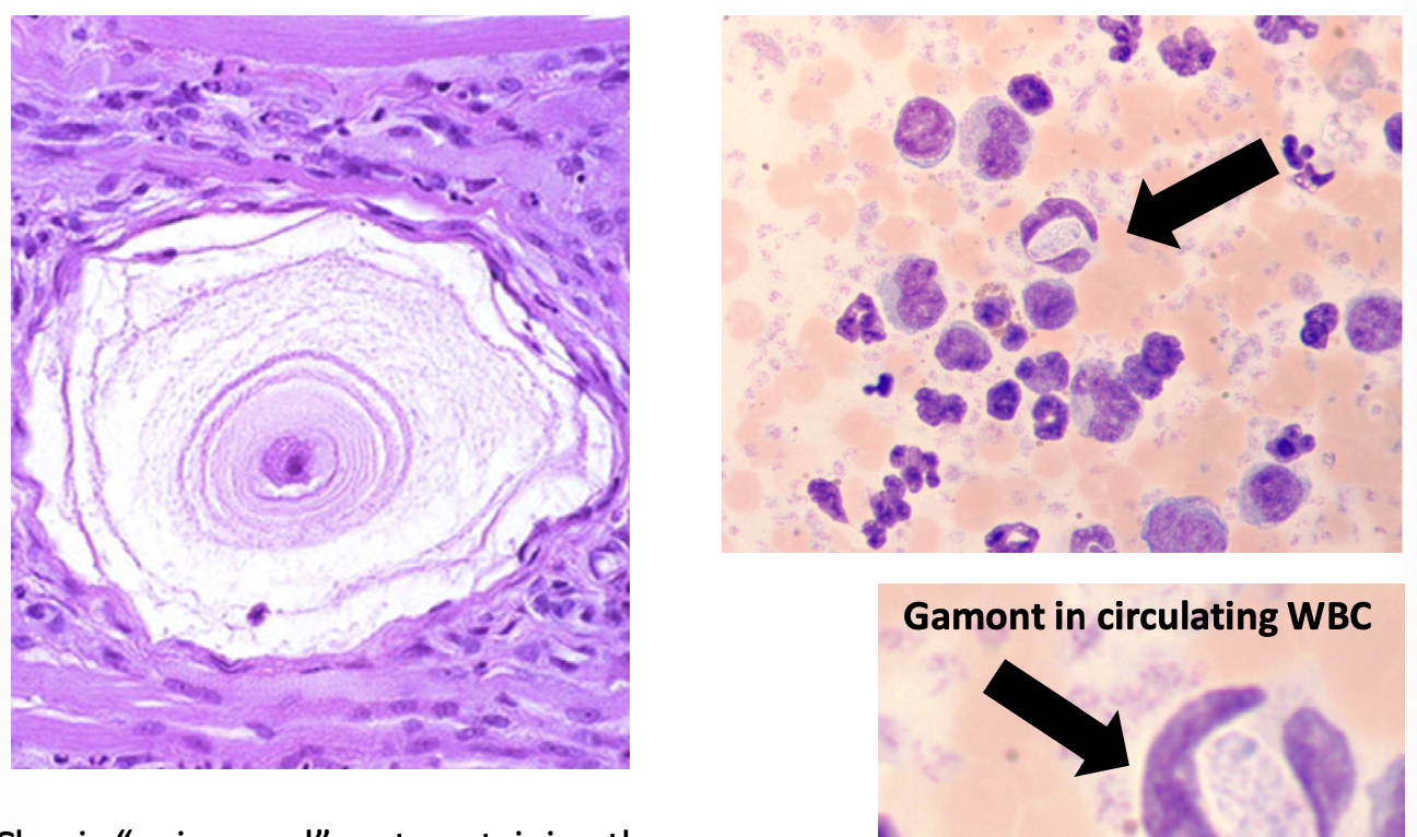 <p>what coccidia species does this image represent?</p>